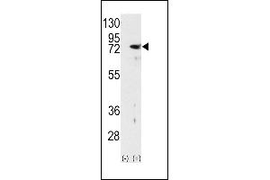 Western blot analysis of PKC delta (arrow) using rabbit polyclonal PKC delta Antibody (N-term) (ABIN391006 and ABIN2841179).