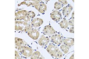 Immunohistochemistry of paraffin-embedded human stomach using cdc45 antibody (ABIN5971079) at dilution of 1/100 (40x lens). (CDC45 antibody)