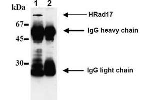 Western Blotting (WB) image for anti-RAD17 (RAD17) antibody (ABIN492574) (RAD17 antibody)