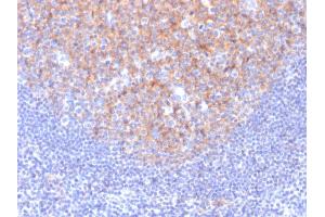 Formalin-fixed, paraffin-embedded human Tonsil stained with CD81 Mouse Monoclonal Antibody (1.