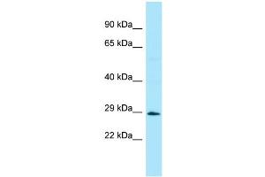 WB Suggested Anti-STAP1 Antibody Titration: 1. (STAP1 antibody  (Middle Region))
