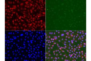 Immunofluorescence analysis of U2OS cell using RAD9A antibody. (RAD9A antibody)