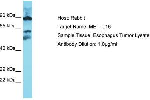 Host: Rabbit Target Name: METTL16 Sample Type: Esophagus Tumor lysates Antibody Dilution: 1. (METTL16 antibody  (Middle Region))