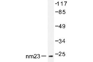 Image no. 1 for anti-Non-Metastatic Cells 1, Protein (NM23A) Expressed in (NME1) antibody (ABIN271902) (NME1 antibody)