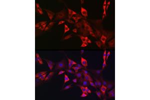 Immunofluorescence analysis of NIH/3T3 cells using CD117/c-Kit antibody (ABIN6133454, ABIN6142896, ABIN6142898 and ABIN6213818) at dilution of 1:50. (KIT antibody  (AA 25-295))