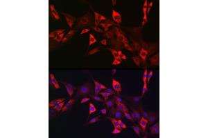 Immunofluorescence analysis of NIH/3T3 cells using CD117/c-Kit antibody (ABIN6133454, ABIN6142896, ABIN6142898 and ABIN6213818) at dilution of 1:50.