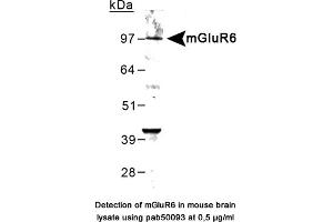 Image no. 1 for anti-Glutamate Receptor, Metabotropic 6 (GRM6) (C-Term) antibody (ABIN363402) (Metabotropic Glutamate Receptor 6 antibody  (C-Term))