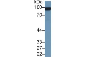 Western Blot; Sample: Rat Uterus lysate; Primary Ab: 1µg/ml Rabbit Anti-Rat MCAM Antibody Second Ab: 0. (MCAM antibody  (AA 323-560))
