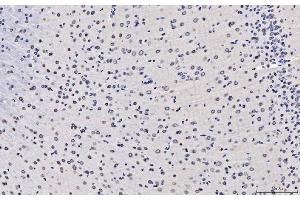 IHC analysis of TPR using anti-TPR antibody (ABIN7603243).