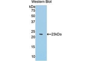 Western blot analysis of the recombinant protein. (IFNA antibody  (AA 1-187))