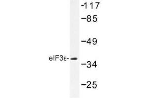 Image no. 1 for anti-Eukaryotic Translation Initiation Factor 3 Subunit E (EIF3E) antibody (ABIN317905) (EIF3E antibody)
