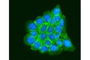 IF analysis of RPLP0 using anti-RPLP0 antibody (ABIN7599197).