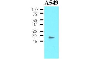 Western Blotting (WB) image for anti-Protein Phosphatase 1, Regulatory (Inhibitor) Subunit 14A (PPP1R14A) (AA 1-147) antibody (ABIN377238) (CPI-17 antibody  (AA 1-147))