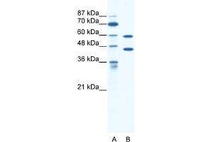 WB Suggested Anti-CATSPER2 Antibody Titration:  1. (CATSPER2 antibody  (C-Term))