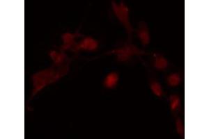 ABIN6274240 staining COLO205 cells by IF/ICC. (HOXD12 antibody  (Internal Region))