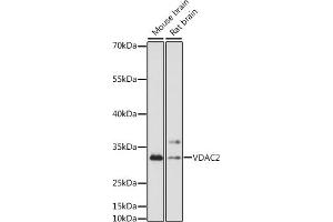 Western blot analysis of extracts of various cell lines, using VD antibody (ABIN7271336) at 1:1000 dilution. (VDAC2 antibody  (AA 1-309))