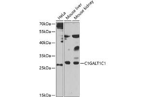 Western blot analysis of extracts of various cell lines, using C1GC1 antibody (ABIN6131024, ABIN6137748, ABIN6137749 and ABIN6223501) at 1:1000 dilution.
