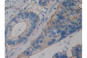 Immunohistochemistry (IHC) image for anti-Actinin, alpha 4 (ACTN4) (AA 1-269) antibody (ABIN7440797)