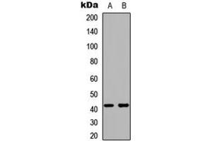 Western blot analysis of Kappa Opioid Receptor expression in HeLa (A), HepG2 (B) whole cell lysates. (OPRK1 antibody  (C-Term))
