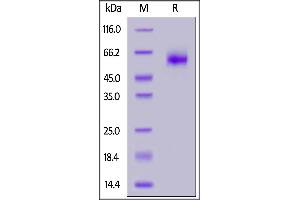 Human IL-1 Rrp2 (C154S, C262S), His Tag on  under reducing (R) condition. (IL1RL2 Protein (AA 20-335) (His tag))