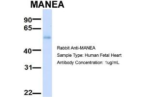 Host:  Rabbit  Target Name:  MANEA  Sample Type:  Human Fetal Heart  Antibody Dilution:  1. (MANEA antibody  (Middle Region))