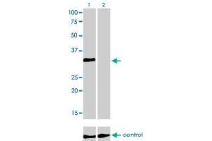 Western blot analysis of HOXC4 over-expressed 293 cell line, cotransfected with HOXC4 Validated Chimera RNAi (Lane 2) or non-transfected control (Lane 1). (HOXC4 antibody  (AA 160-264))