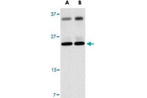Western blot analysis of THEM4 in human liver tissue lysate with THEM4 polyclonal antibody  at (A) 1 and (B) 2 ug/mL . (THEM4 antibody  (Internal Region))