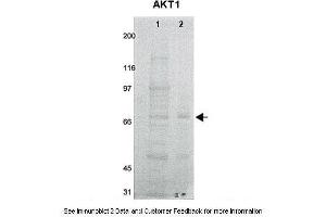 Lanes:   1. (AKT1 antibody  (N-Term))