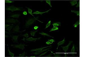 Immunofluorescence of monoclonal antibody to HTT on HeLa cell. (Huntingtin antibody  (AA 1524-1627))