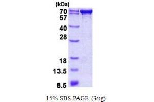 SDS-PAGE (SDS) image for PDZ Domain Containing 1 (PDZK1) (AA 1-519) protein (His tag) (ABIN5852951)