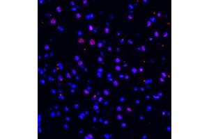 Immunofluorescence of paraffin embedded mouse brain using ZNF682 (ABIN7076270) at dilution of 1:400 (400x lens) (ZNF682 antibody)