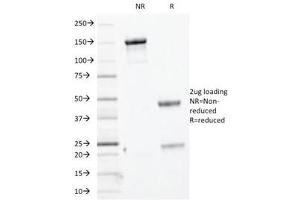 SDS-PAGE Analysis of Purified, BSA-Free Basic Cytokeratin Antibody (clone KRTH/1076).