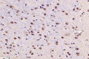 Immunohistochemistry analysis of paraffin-embedded ratsubstantia nigrausing PARC (ABIN7073606) at dilution of 1:1200 (CUL9 antibody)