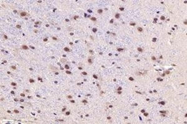 CUL9 antibody