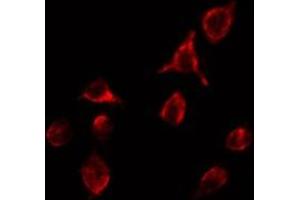 ABIN6266742 staining RAW264. (TNFRSF1B antibody  (C-Term))