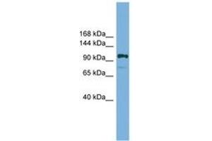 Image no. 1 for anti-HIR Histone Cell Cycle Regulation Defective Homolog A (HIRA) (AA 601-650) antibody (ABIN6744564)