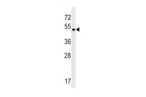 Western blot analysis in A2058 cell line lysates (35ug/lane). (ZNF559 antibody  (AA 196-224))