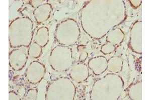 Immunohistochemistry of paraffin-embedded human thyroid tissue using ABIN7161775 at dilution of 1:100 (NFIL3 antibody  (AA 133-462))