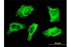 Immunofluorescence of monoclonal antibody to MYH9 on HeLa cell. (Myosin 9 antibody  (AA 131-220))