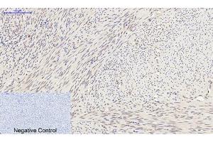 Immunohistochemical analysis of paraffin-embedded human uterus tissue. (SYN1 antibody)