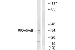 Western blot analysis of extracts from HepG2 cells, using RRAGA/B antibody. (RRAGA/B antibody  (C-Term))