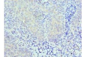 Immunohistochemistry of paraffin-embedded human tonsil tissue using ABIN7146923 at dilution of 1:100 (CARD8 antibody  (AA 1-200))