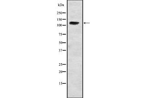 Western blot analysis of USP37 expression in Hela cell lysate,The lane on the left is treated with the antigen-specific peptide. (USP37 antibody  (Internal Region))