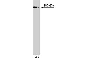 Western blot analysis of IRS-1 on RSV-3T3 cell lysate. (IRS1 antibody  (AA 1131-1234))