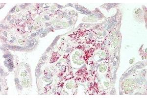 Detection of Slit2 in Human Placenta Tissue using Polyclonal Antibody to Slit Homolog 2 (Slit2) (SLIT2 antibody  (AA 1160-1333))