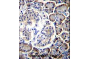 SMAP2 Antibody immunohistochemistry analysis in formalin fixed and paraffin embedded human pancreas tissue followed by peroxidase conjugation of the secondary antibody and DAB staining.