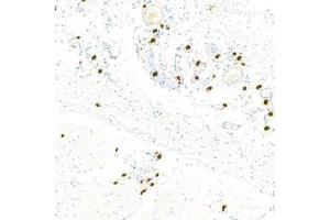 Immunohistochemistry analysis of paraffin-embedded rat skinusing Chymase (ABIN7073506) at dilution of 1:1000
