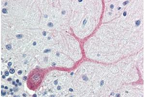 Human Brain, Cerebellum (formalin-fixed, paraffin-embedded) stained with BIRC7 antibody ABIN214412 at 5 ug/ml followed by biotinylated goat anti-rabbit IgG secondary antibody ABIN481713, alkaline phosphatase-streptavidin and chromogen. (BIRC7 antibody  (AA 264-280))