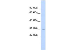 WB Suggested Anti-NFKBIA Antibody Titration:  0. (NFKBIA antibody  (N-Term))