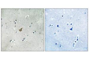 Immunohistochemistry (IHC) image for anti-EPH Receptor A3 (EPHA3) (pTyr779), (pTyr833) antibody (ABIN1847593) (EPH Receptor A3 antibody  (pTyr779, pTyr833))